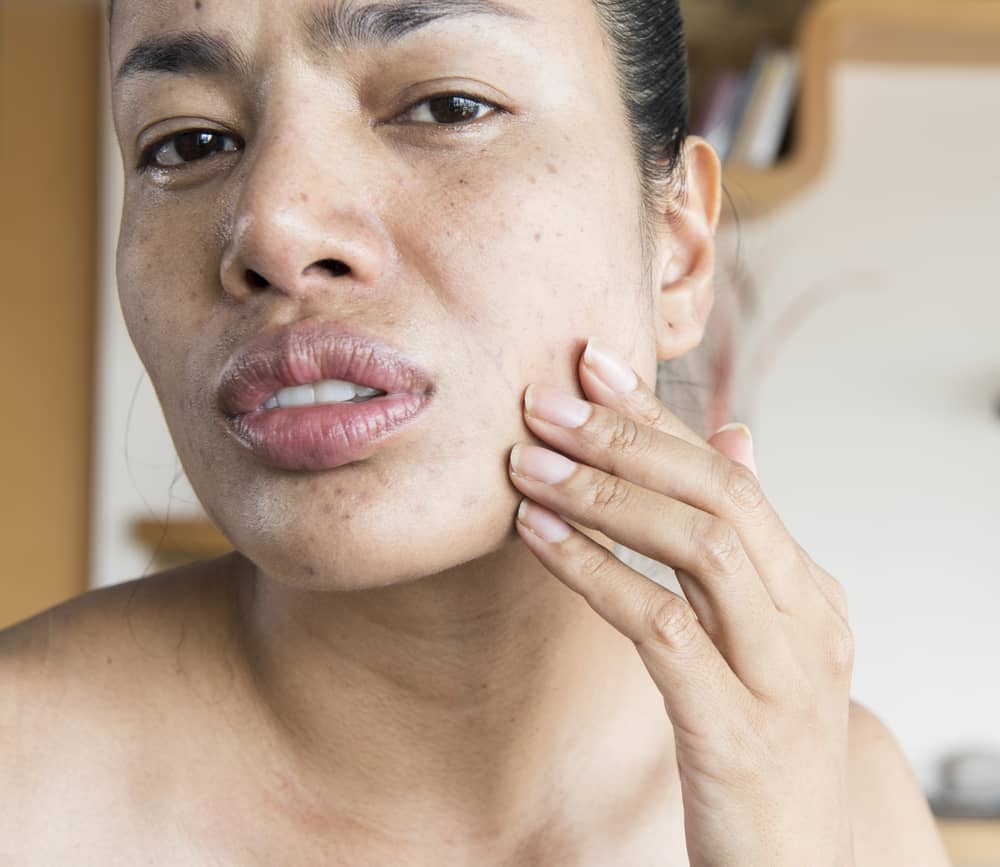 woman touching face